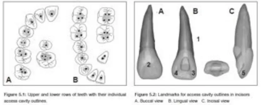 Access for Root Canal Treatment-1764840263028.webp