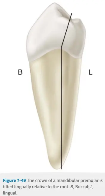 Access for Root Canal Treatment-1764840516739.webp165x307