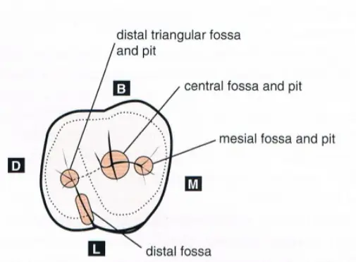 Access for Root Canal Treatment-1764840683762.webp
