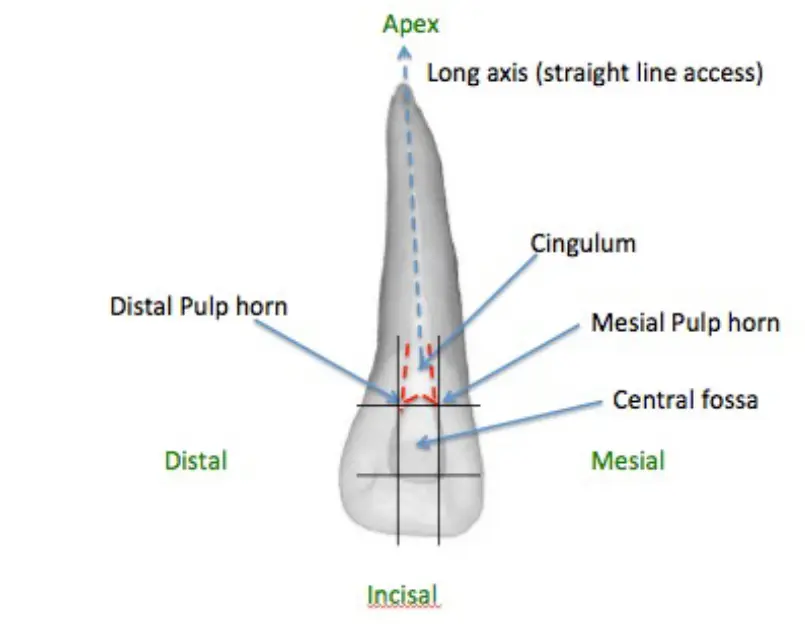 Access for Root Canal Treatment-1764841194107.webp406x315