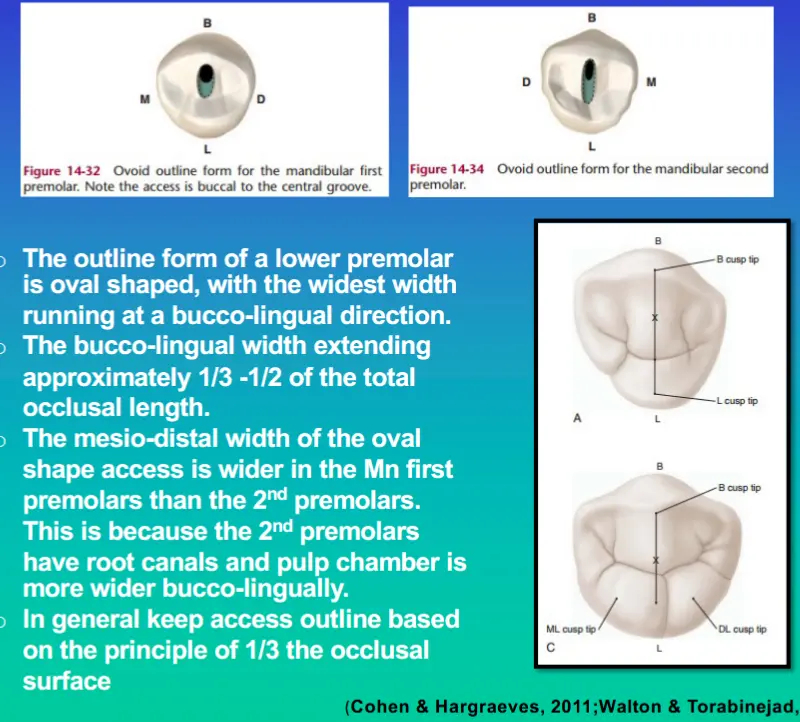 Access for Root Canal Treatment-1764841836554.webp510x460