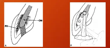 Bleaching of Endodontically Treated Teeth-1765465508808.webp