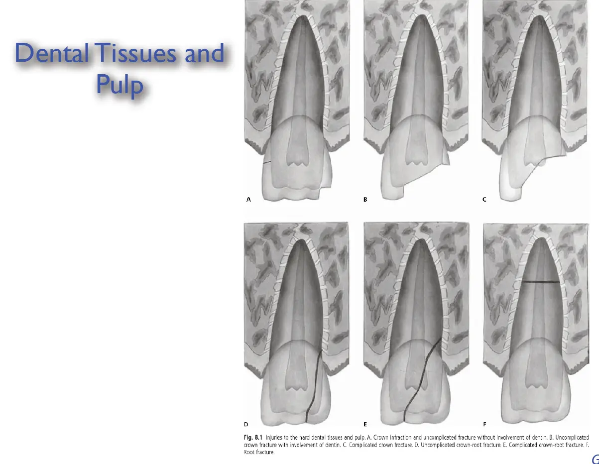 Dentoalveolar Trauma 1-1765268663831.webp