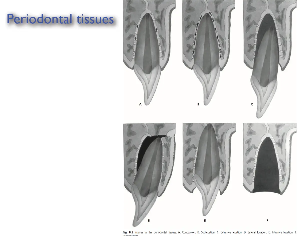 Dentoalveolar Trauma 1-1765268677137.webp
