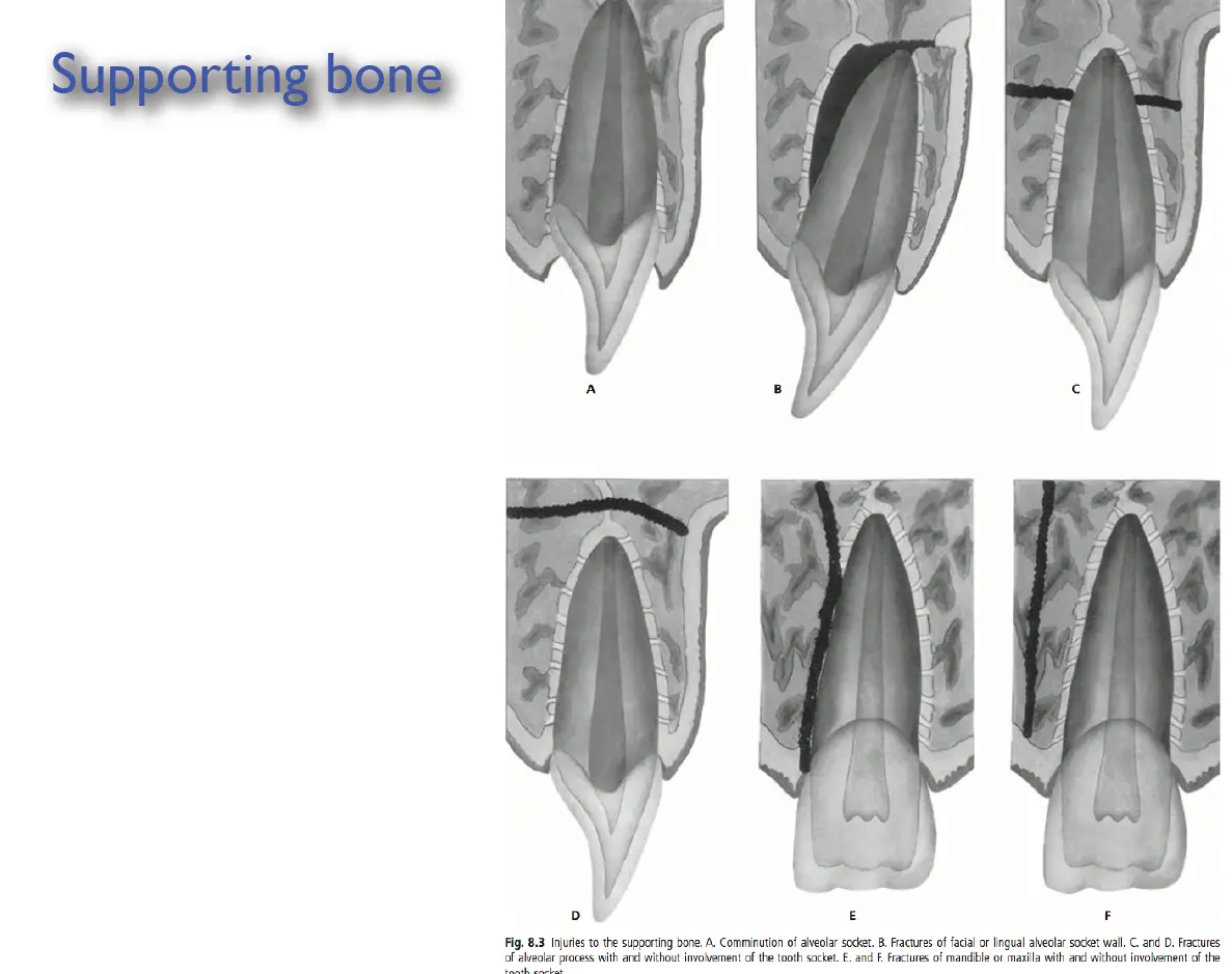 Dentoalveolar Trauma 1-1765268687154.webp