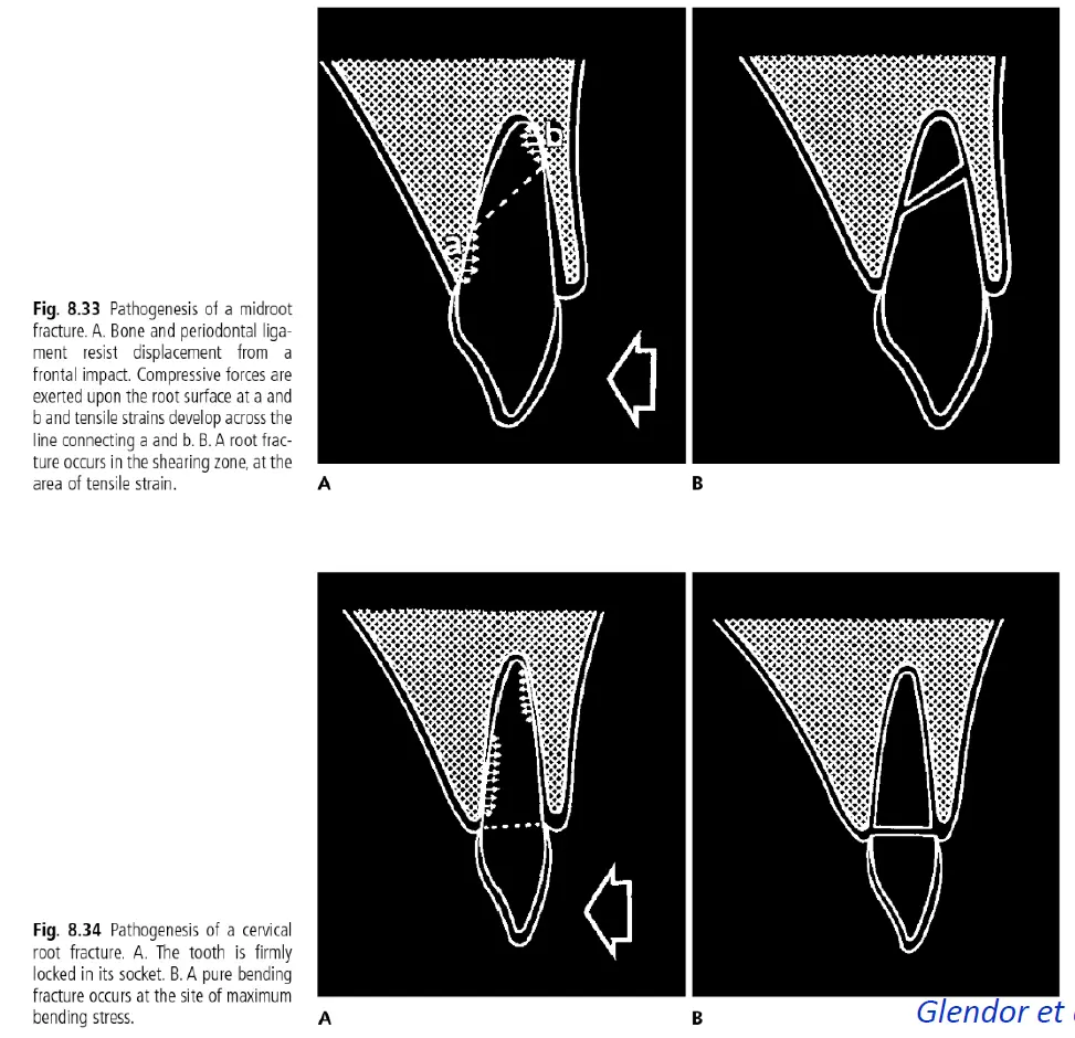 Dentoalveolar Trauma 1-1765268861448.webp
