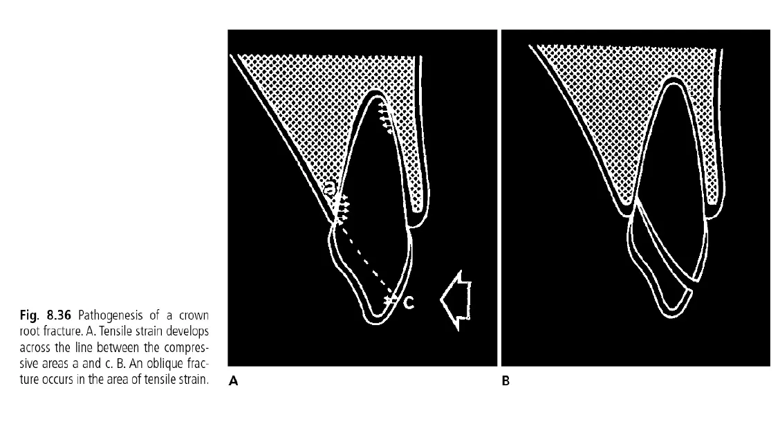 Dentoalveolar Trauma 1-1765268868822.webp