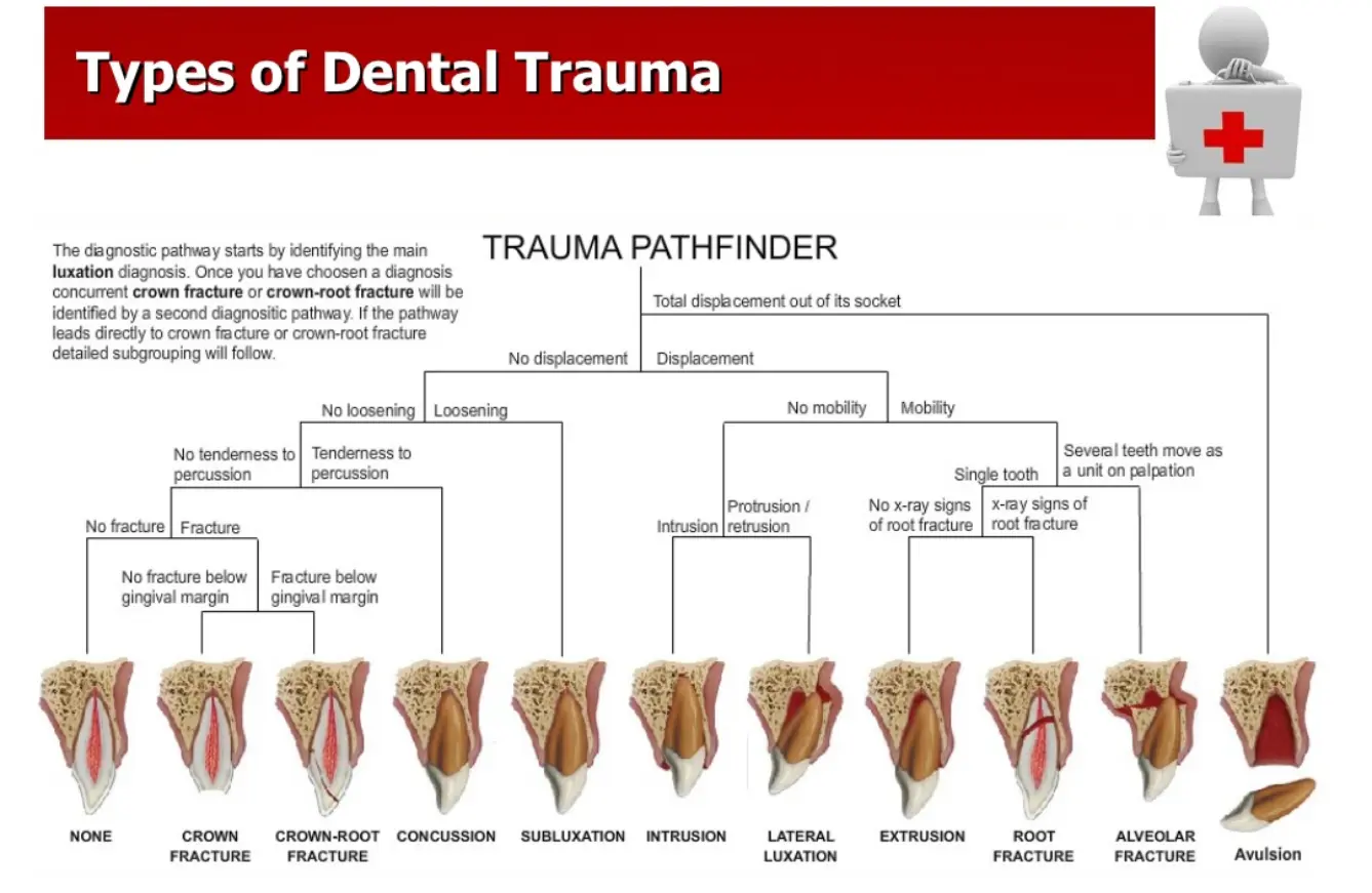 Dentoalveolar Trauma 1-1765268880130.webp