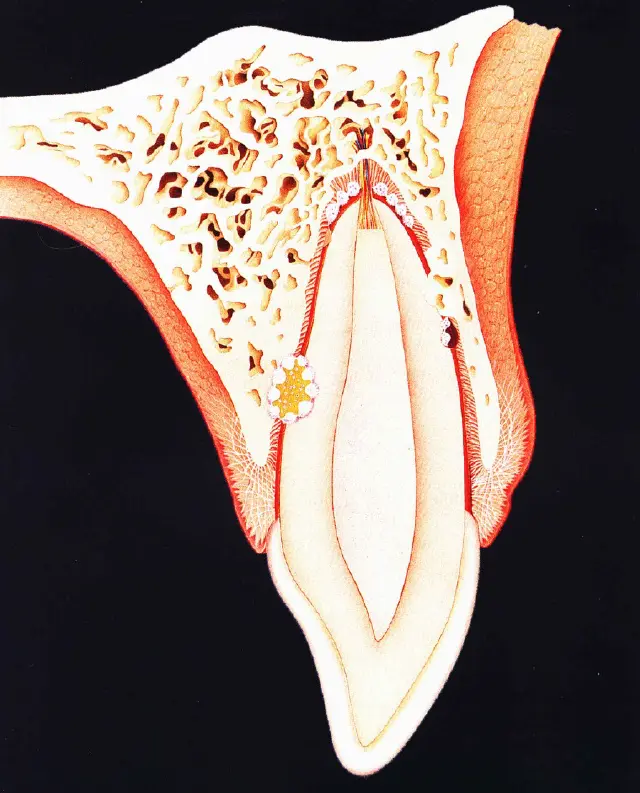 Dentoalveolar Trauma 1-1765269821142.webp360x446