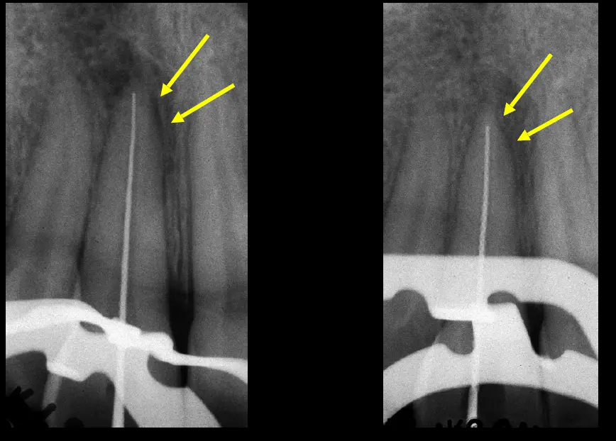 Dentoalveolar Trauma 1-1765269829233.webp