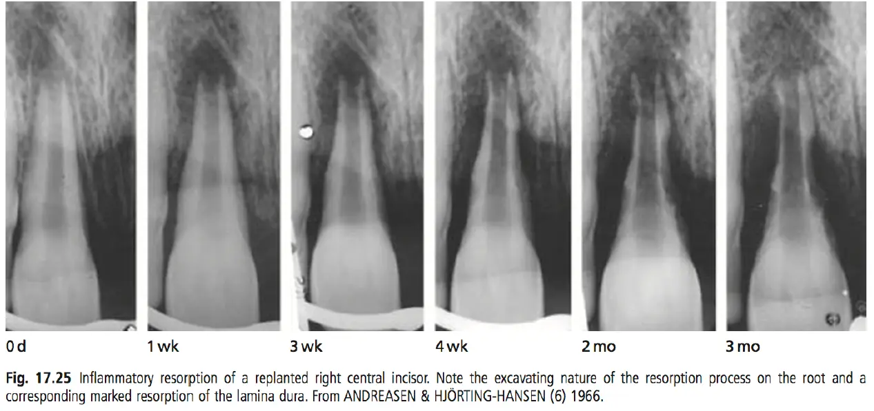 Dentoalveolar Trauma 1-1765269852738.webp601x283