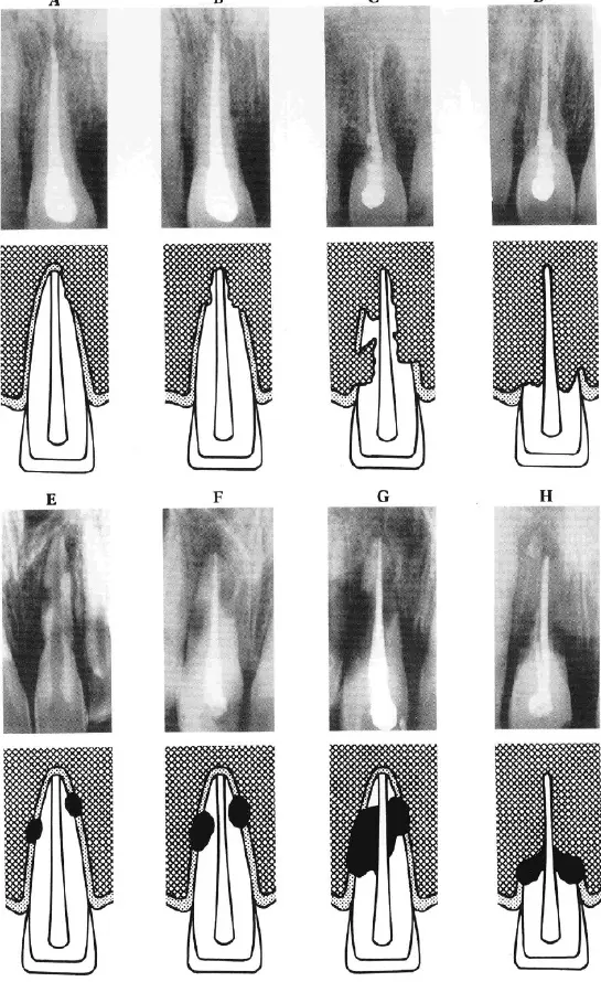 Dentoalveolar Trauma 1-1765270972033.webp