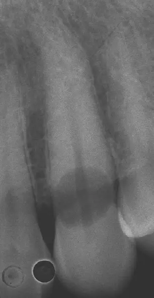 Dentoalveolar Trauma 1-1765271241159.webp247x479