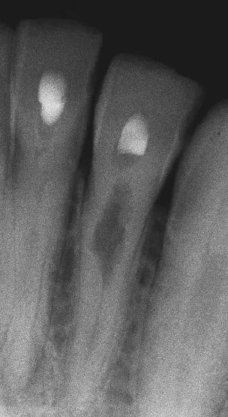 Dentoalveolar Trauma 1-1765271406509.webp