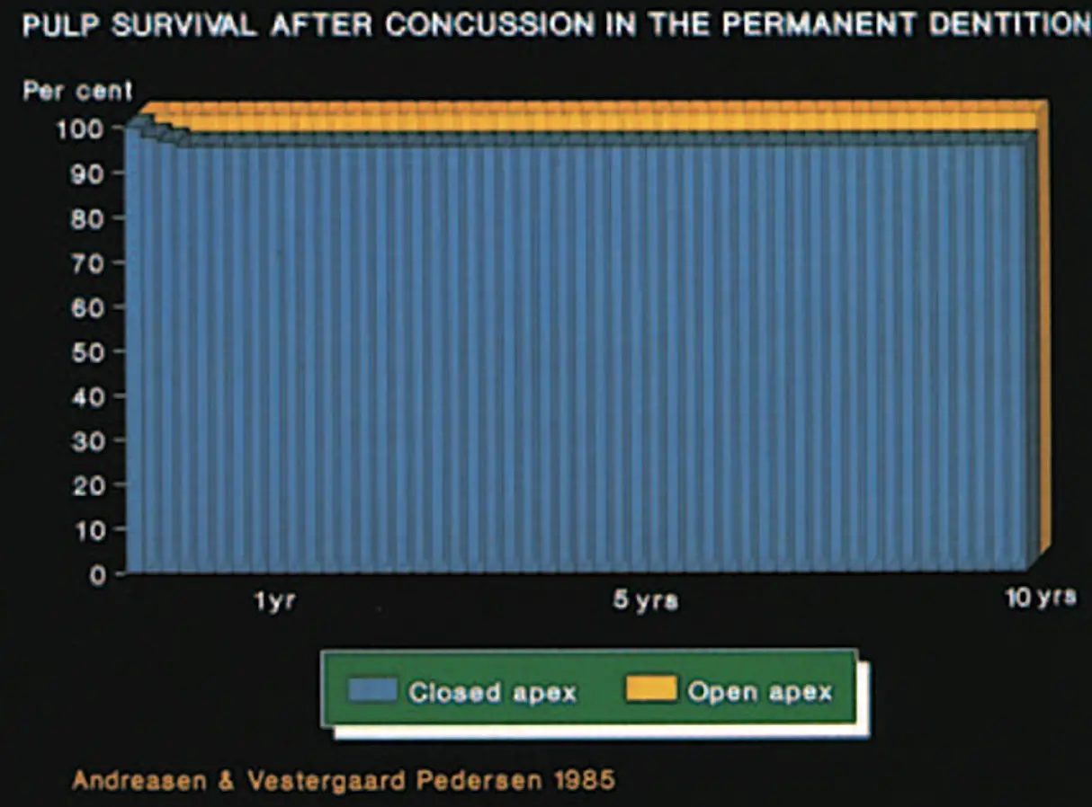 Dentoalveolar Trauma 1-1765271943967.webp582x430