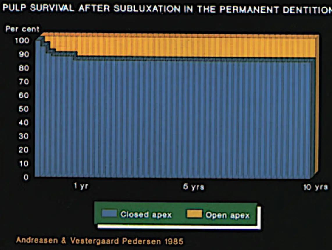 Dentoalveolar Trauma 1-1765271953629.webp584x439