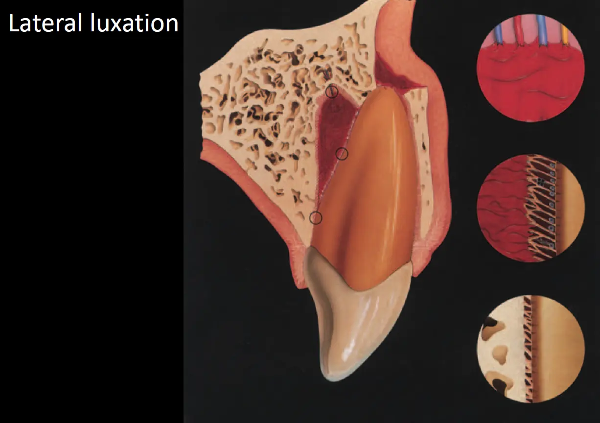 Dentoalveolar Trauma 1-1765346944062.webp520x366