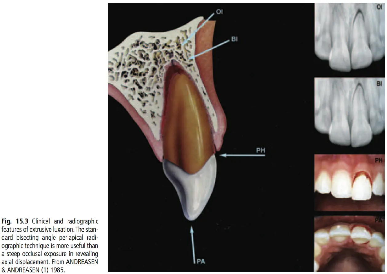 Dentoalveolar Trauma 1-1765347041429.webp470x333