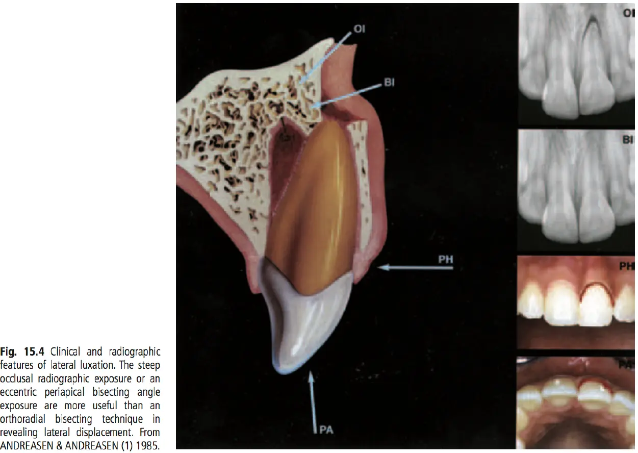 Dentoalveolar Trauma 1-1765347069557.webp469x333