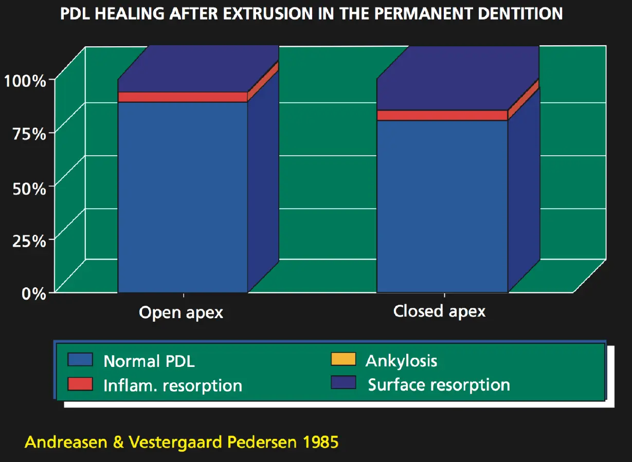 Dentoalveolar Trauma 1-1765347247594.webp533x390