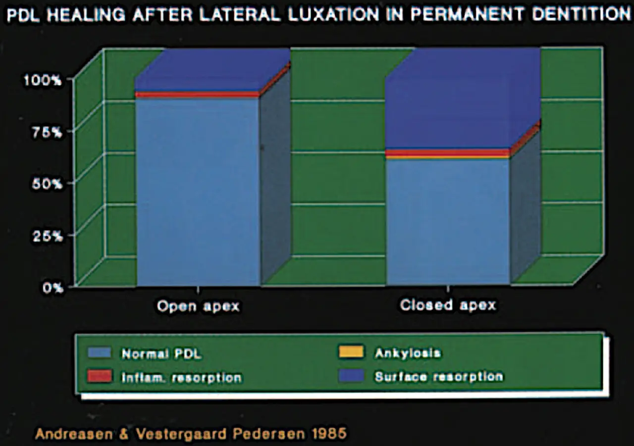 Dentoalveolar Trauma 1-1765347259725.webp532x374