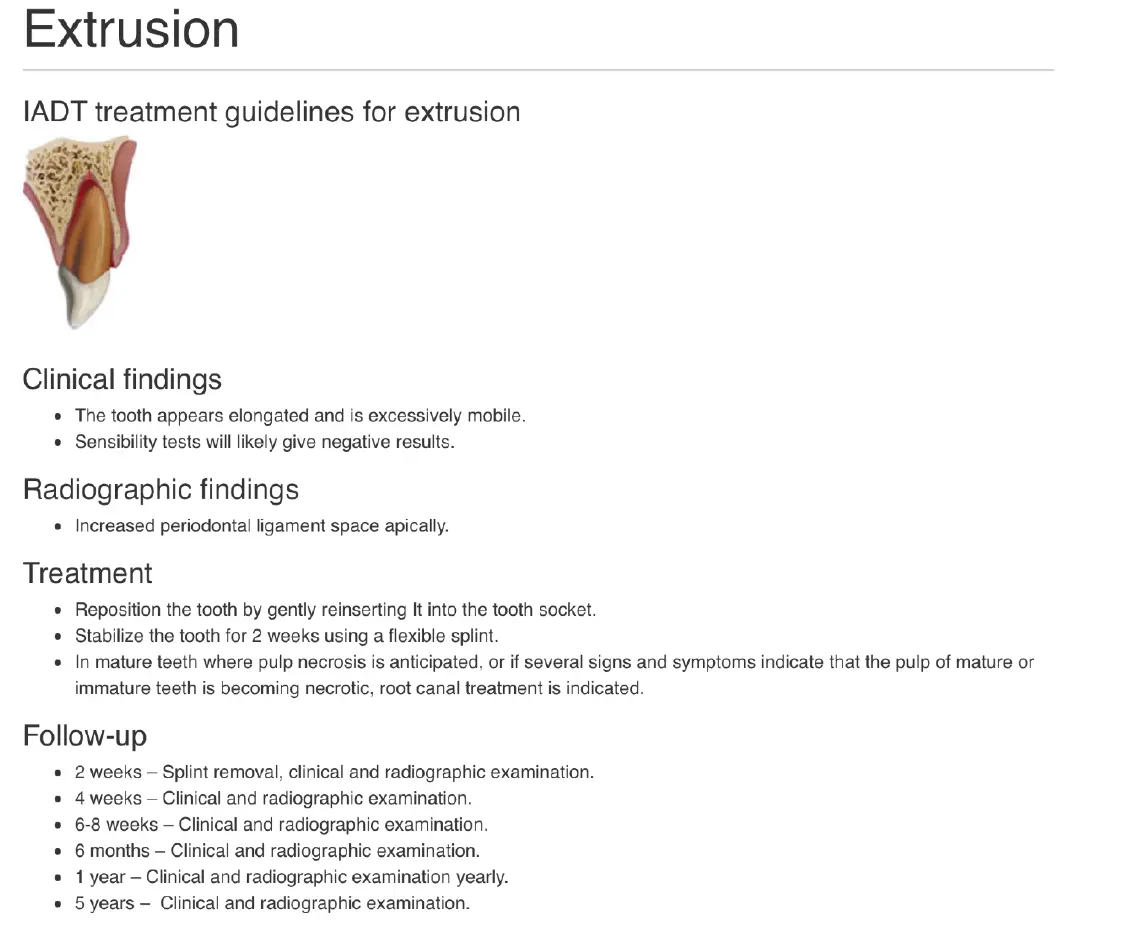Dentoalveolar Trauma 1-1765347323607.webp700x576