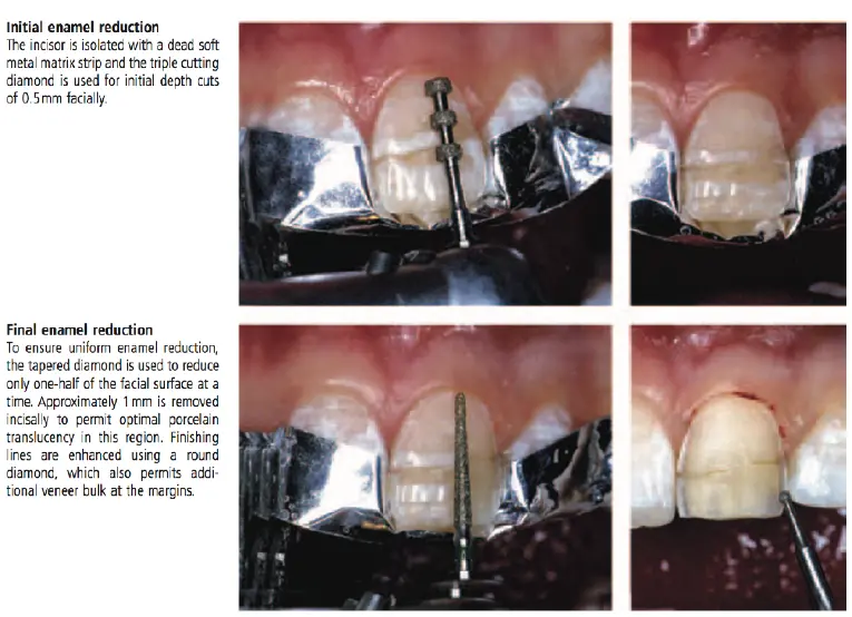 Dentoalveolar Trauma 1-1765349119404.webp