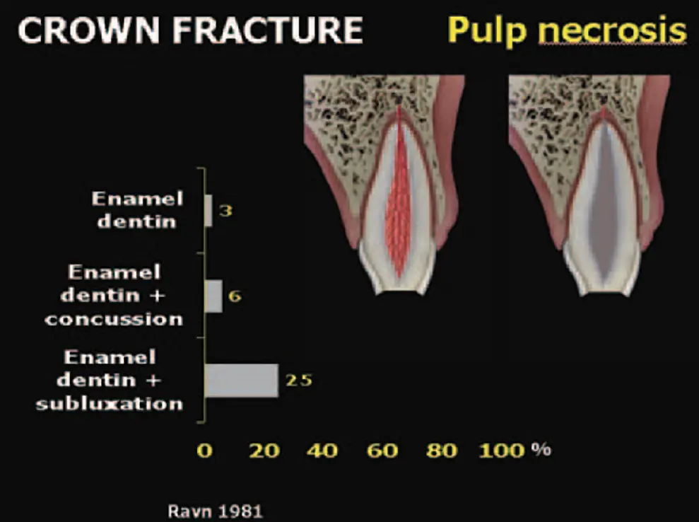 Dentoalveolar Trauma 1-1765349489212.webp