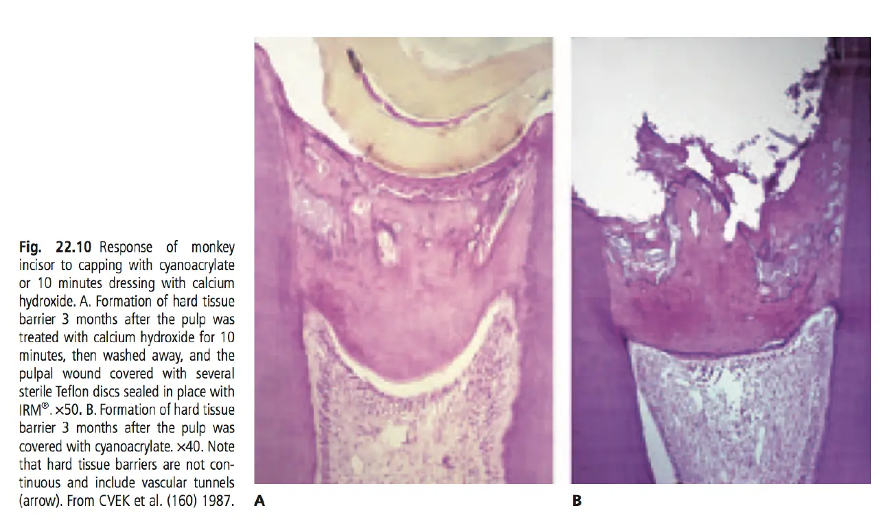 Dentoalveolar Trauma 1-1765349597847.webp