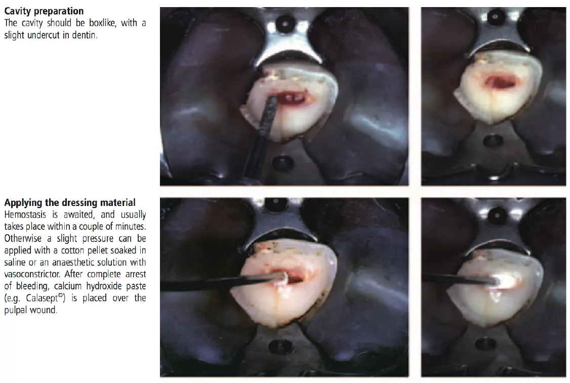 Dentoalveolar Trauma 1-1765349724199.webp