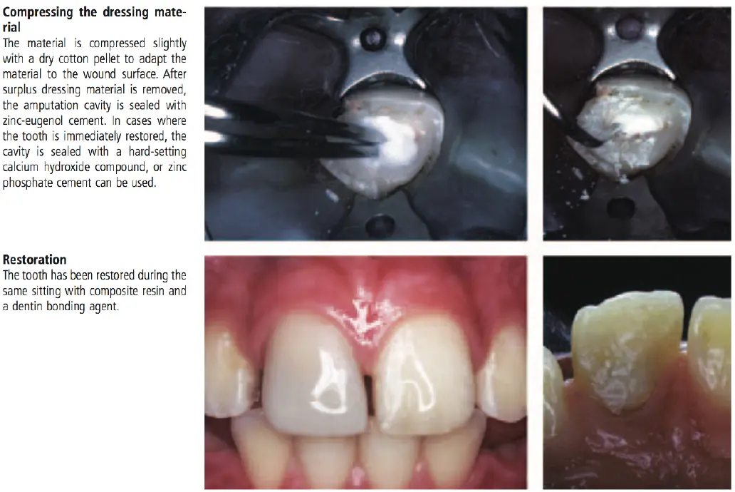 Dentoalveolar Trauma 1-1765349739450.webp