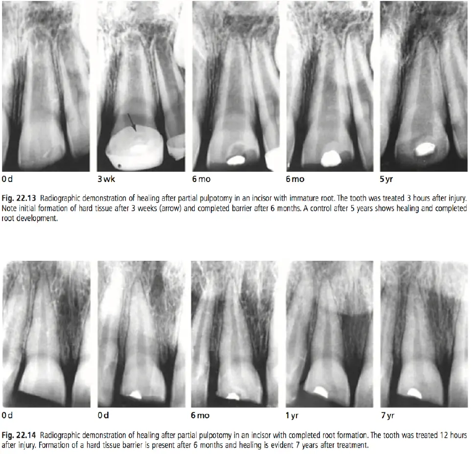 Dentoalveolar Trauma 1-1765349775770.webp