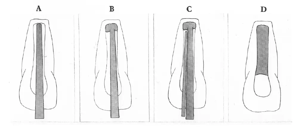 Dentoalveolar Trauma 1-1765349986611.webp