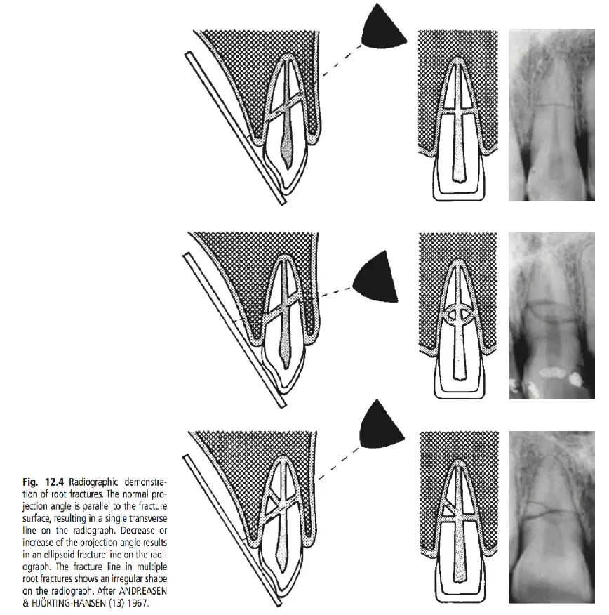 Dentoalveolar Trauma-1765350196920.webp