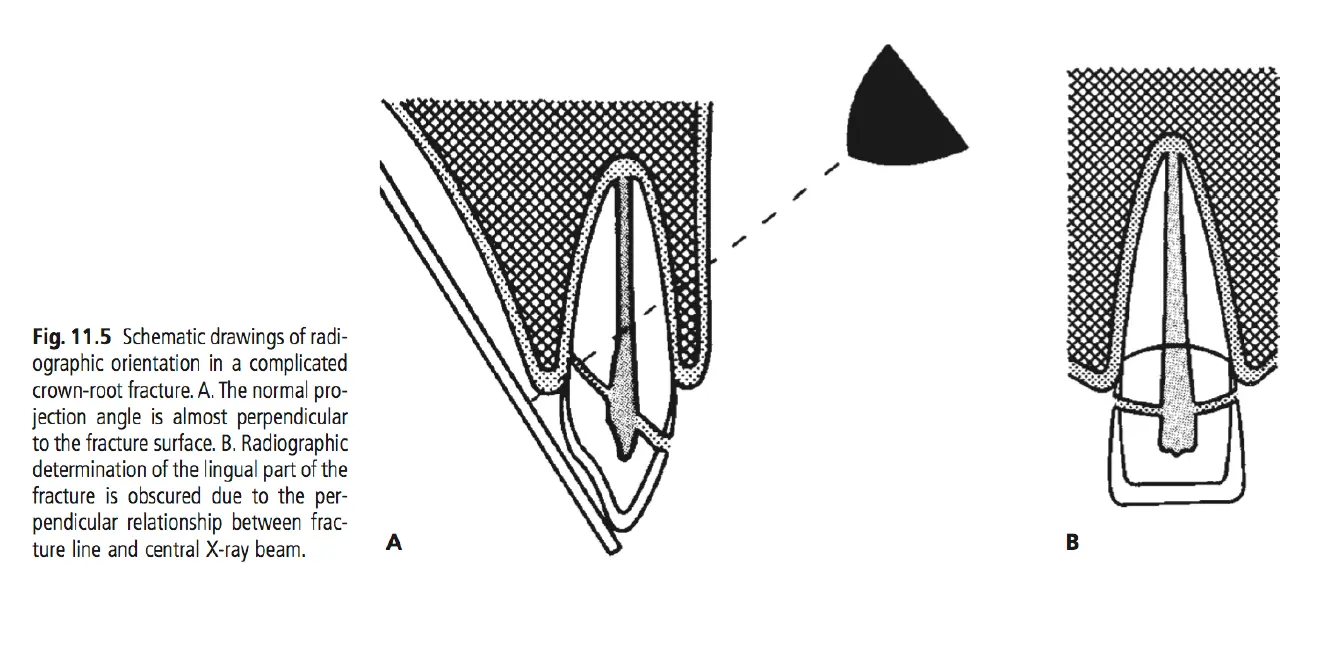 Dentoalveolar Trauma-1765350555983.webp
