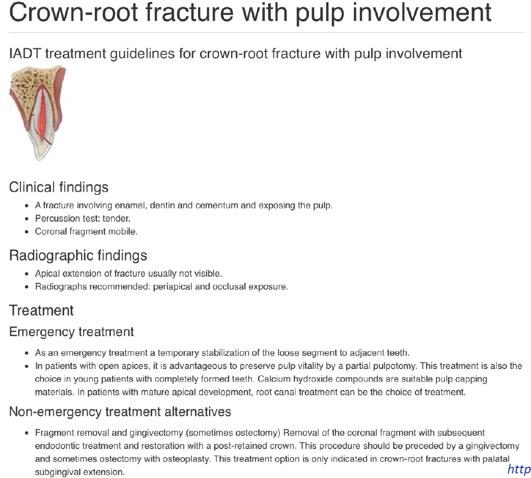 Dentoalveolar Trauma-1765351383013.webp
