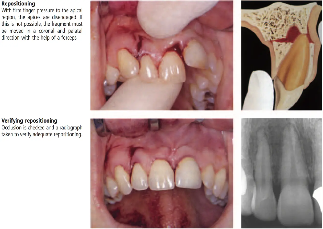 Dentoalveolar Trauma-1765351487877.webp
