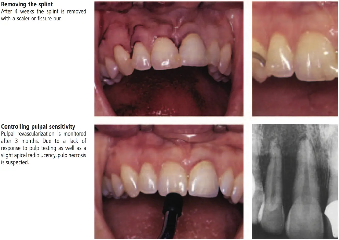 Dentoalveolar Trauma-1765351539204.webp