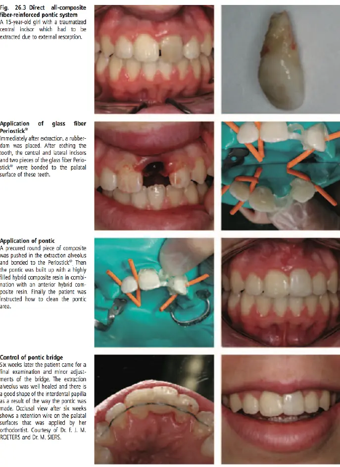 Dentoalveolar Trauma-1765352015979.webp