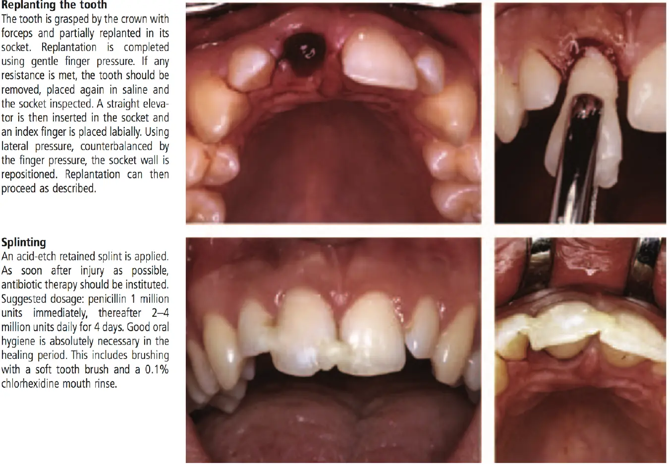 Dentoalveolar Trauma-1765352107651.webp