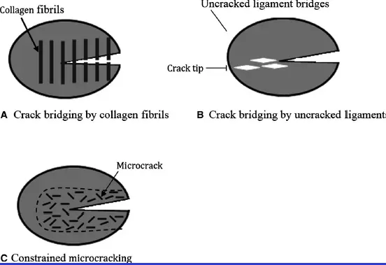 Diagnosis and Management of Cracked & Fractured Teeth-1765427568882.webp