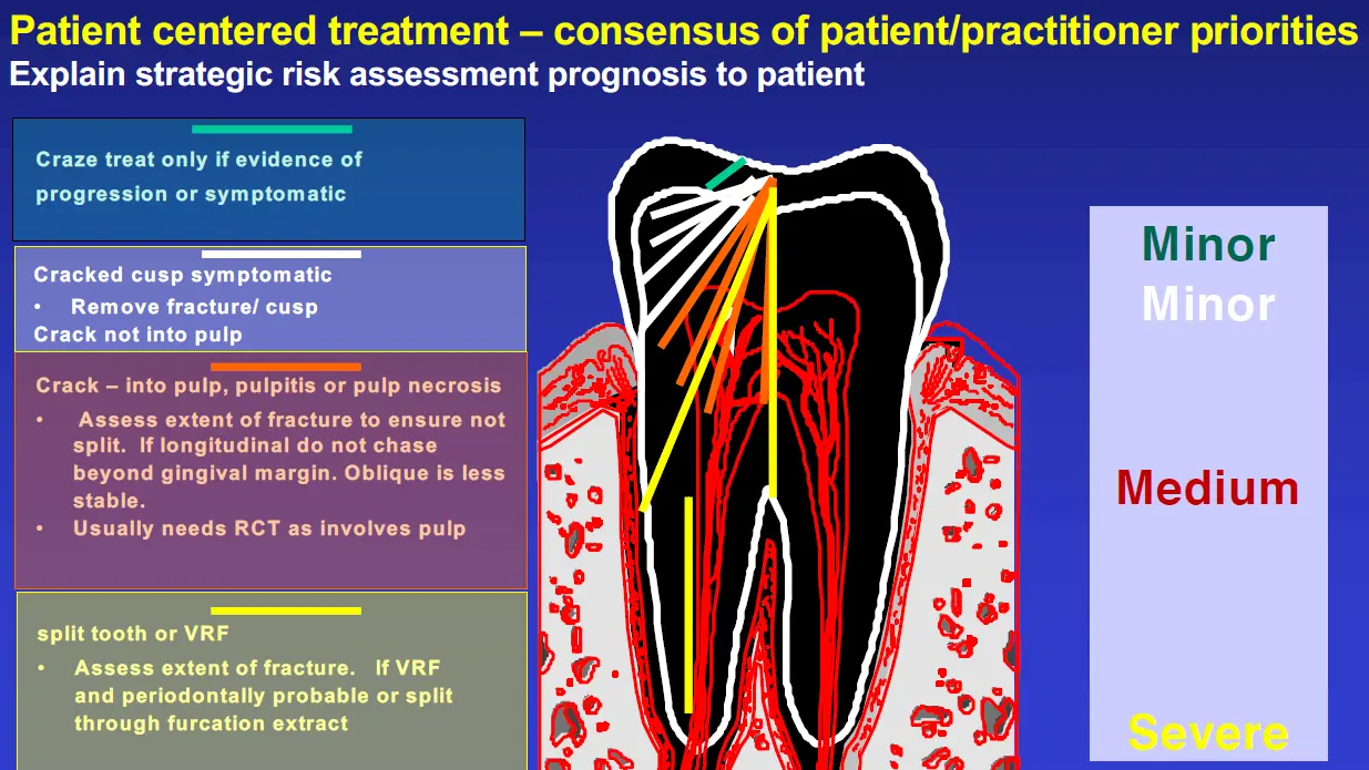 Diagnosis and Management of Cracked & Fractured Teeth-1765433762373.webp
