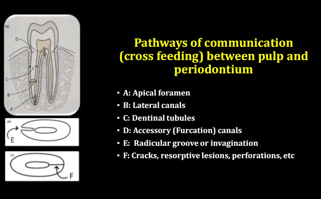 Diagnosis and management of concurrent endodontic and periodontal diseases-1765177746759.webp635x394