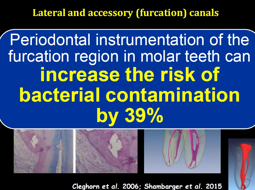 Diagnosis and management of concurrent endodontic and periodontal diseases-1765177848820.webp550x410
