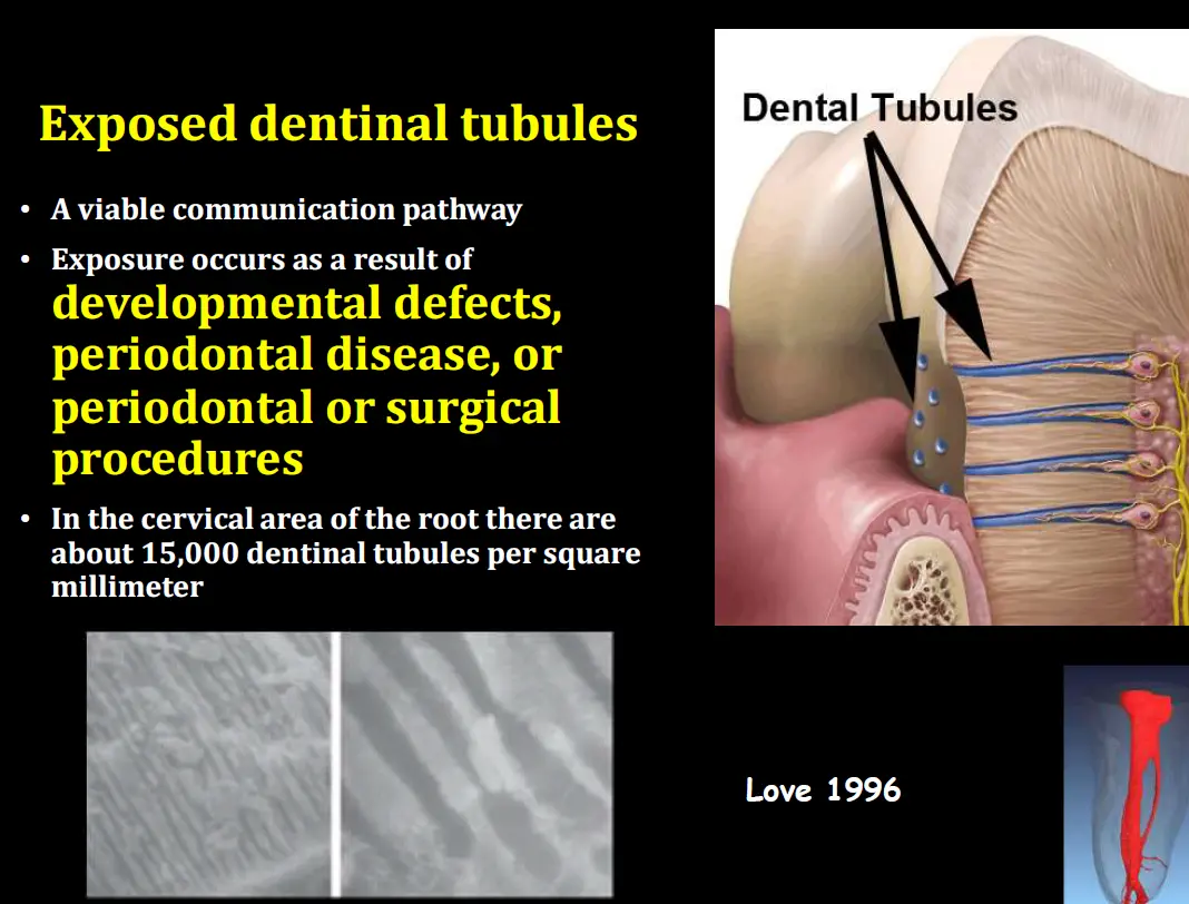 Diagnosis and management of concurrent endodontic and periodontal diseases-1765177865421.webp559x425