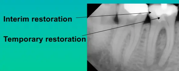 Endodontic Armamentarium-1764839008705.webp472x189
