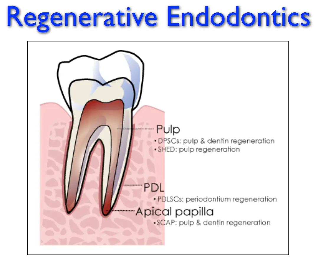 Endodontic Management of Immature Teeth-1765464171042.webp