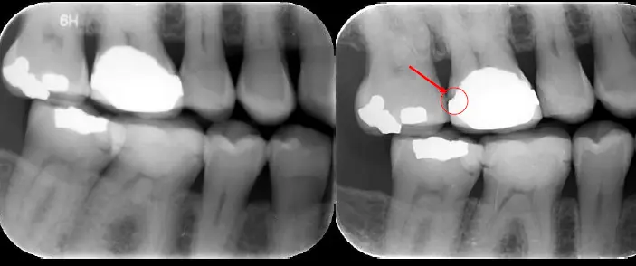 Endodontic Radiography and Working length determination-1764861379563.webp
