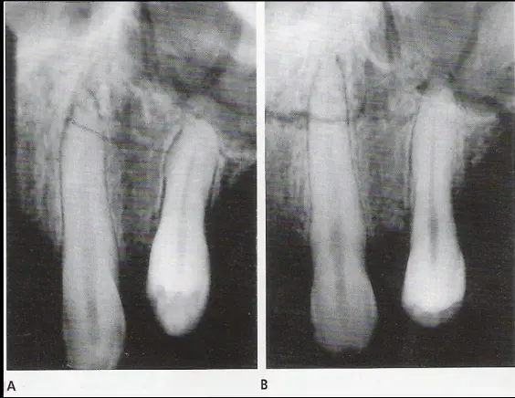 Endodontic Radiography and Working length determination-1764861479400.webp