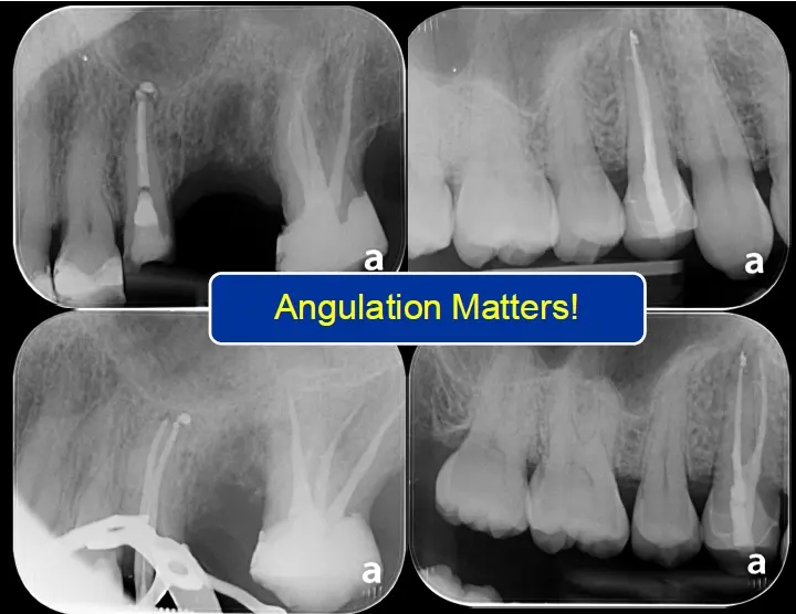 Endodontic Radiography and Working length determination-1764861530192.webp